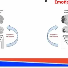 Diagram som visar hur dopamin och saliens påverkar emotionell och icke-emotionell bearbetning vid ADHD och emotionell instabilitet.
