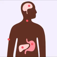 Illustration av en människa med markerade organ som hjärna, hals, mage och lever. Röda prickar visar var stress kan påverka kroppen, och frågan "kan man få feber av stress?" dyker upp.