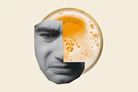 Ansiktet delas av ett glas öl, en visuell representation av permanenta skador av alkohol som påverkar både kropp och sinne.