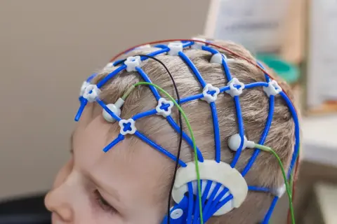 Barn med EEG-hjälm, forskning om magnesium och adhd.