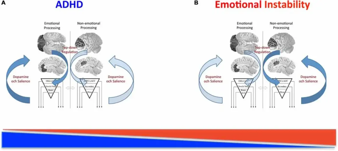Diagram som visar hur dopamin och saliens påverkar emotionell och icke-emotionell bearbetning vid ADHD och emotionell instabilitet.